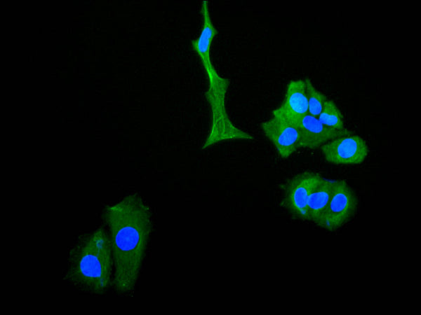 Immunofluorescence staining of MCF-7 cell with CSB-RA582667A0HU at 1:50 , counter-stained with DAPI. The cells were fixed in 4% formaldehyde, permeabilized using 0.2% Triton X-100 and blocked in 10% normal Goat Serum. The cells were then incubated with the antibody overnight at 4°C. The secondary antibody was Alexa Fluor 488-congugated AffiniPure Goat Anti-Rabbit IgG(H+L).