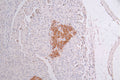 IHC image of CSB-RA582749A0HU diluted at 1:50 and staining in paraffin-embedded human pancreati  tissue performed on a Leica BondTM system. After dewaxing and hydration, antigen retrieval was mediated by high pressure in a citrate buffer (pH 6.0) . Section was blocked with 10% normal goat serum 30min at RT. Then primary antibody (1% BSA) was incubated at 4°C overnight. The primary is detected by a Goat anti-rabbit polymer IgG labeled by HRP and visualized using 0.34% DAB.