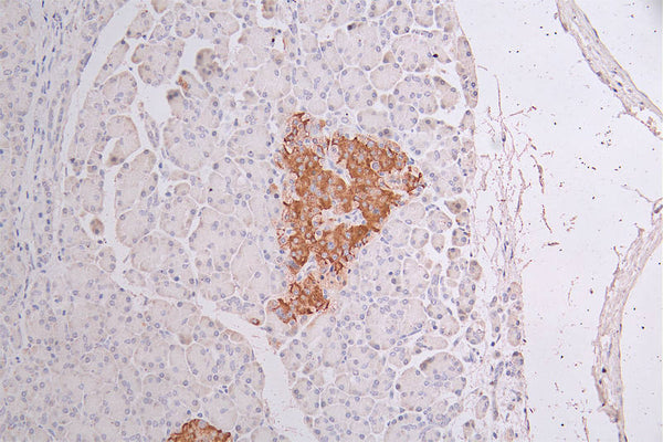 IHC image of CSB-RA582749A0HU diluted at 1:50 and staining in paraffin-embedded human pancreati  tissue performed on a Leica BondTM system. After dewaxing and hydration, antigen retrieval was mediated by high pressure in a citrate buffer (pH 6.0) . Section was blocked with 10% normal goat serum 30min at RT. Then primary antibody (1% BSA) was incubated at 4°C overnight. The primary is detected by a Goat anti-rabbit polymer IgG labeled by HRP and visualized using 0.34% DAB.