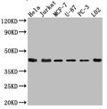 Western Blot
Positive WB detected in: Hela whole cell lysate, Jurkat whole cell lysate, MCF-7 whole cell lysate, U-87 whole cell lysate, PC-3 whole cell lysate, L02 whole cell lysate
All lanes: p38 antibody at 1:1000
Secondary
Goat polyclonal to rabbit IgG at 1/50000 dilution
Predicted band size: 42, 42, 35, 36, 30 kDa
Observed band size: 42 kDa