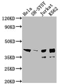 Western Blot
Positive WB detected in: Hela whole cell lysate, SH-SY5Y whole cell lysate, Jurkat whole cell lysate, K562 whole cell lysate
All lanes: ISL1 antibody at 1:2000
Secondary
Goat polyclonal to rabbit IgG at 1/50000 dilution
Predicted band size: 40 kDa
Observed band size: 39 kDa
