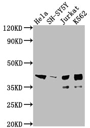 Western Blot
Positive WB detected in: Hela whole cell lysate, SH-SY5Y whole cell lysate, Jurkat whole cell lysate, K562 whole cell lysate
All lanes: ISL1 antibody at 1:2000
Secondary
Goat polyclonal to rabbit IgG at 1/50000 dilution
Predicted band size: 40 kDa
Observed band size: 39 kDa