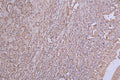 IHC image of CSB-RA583078A0HU diluted at 1:50 and staining in paraffin-embedded human lung tissue performed on a Leica BondTM system. After dewaxing and hydration, antigen retrieval was mediated by high pressure in a citrate buffer (pH 6.0) . Section was blocked with 10% normal goat serum 30min at RT. Then primary antibody (1% BSA) was incubated at 4°C overnight. The primary is detected by a Goat anti-rabbit polymer IgG labeled by HRP and visualized using 0.24% DAB.