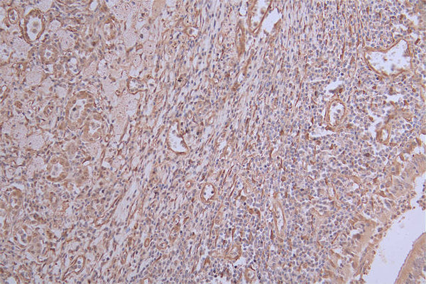 IHC image of CSB-RA583078A0HU diluted at 1:50 and staining in paraffin-embedded human lung tissue performed on a Leica BondTM system. After dewaxing and hydration, antigen retrieval was mediated by high pressure in a citrate buffer (pH 6.0) . Section was blocked with 10% normal goat serum 30min at RT. Then primary antibody (1% BSA) was incubated at 4°C overnight. The primary is detected by a Goat anti-rabbit polymer IgG labeled by HRP and visualized using 0.24% DAB.