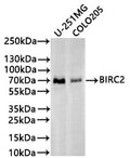 Western Blot
Positive WB detected in: U-251MG whole cell lysate(30µg), COLO-205 whole cell lysate(30µg)
All lanes: BIRC2 antibody at 1:1000
Secondary
Goat polyclonal to rabbit IgG at 1/40000 dilution
Predicted band size: 70 kDa
Observed band size: 70 kDa
Exposure time：2min
