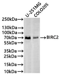 Western Blot
Positive WB detected in: U-251MG whole cell lysate(30µg), COLO-205 whole cell lysate(30µg)
All lanes: BIRC2 antibody at 1:1000
Secondary
Goat polyclonal to rabbit IgG at 1/40000 dilution
Predicted band size: 70 kDa
Observed band size: 70 kDa
Exposure time：2min