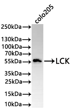 Western Blot
Positive WB detected in: COLO205 whole cell lysate(30µg) 
All lanes: LCK antibody at 1:1000
Secondary
Goat polyclonal to rabbit IgG at 1/50000 dilution
Predicted band size: 58 kDa
Observed band size: 58 kDa
Exposure time: 2min