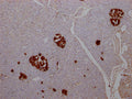 IHC image of CSB-RA584163A0HU diluted at 1:100 and staining in paraffin-embedded human pancreatic tissue performed on a Leica BondTM system. After dewaxing and hydration, antigen retrieval was mediated by high pressure in a citrate buffer (pH 6.0) . Section was blocked with 10% normal goat serum 30min at RT. Then primary antibody (1% BSA) was incubated at 4℃ overnight. The primary is detected by a Goat anti-rabbit IgG polymer labeled by HRP and visualized using 0.05% DAB.