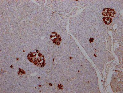 IHC image of CSB-RA584163A0HU diluted at 1:100 and staining in paraffin-embedded human pancreatic tissue performed on a Leica BondTM system. After dewaxing and hydration, antigen retrieval was mediated by high pressure in a citrate buffer (pH 6.0) . Section was blocked with 10% normal goat serum 30min at RT. Then primary antibody (1% BSA) was incubated at 4℃ overnight. The primary is detected by a Goat anti-rabbit IgG polymer labeled by HRP and visualized using 0.05% DAB.