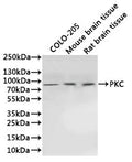 Western Blot
Positive WB detected in: COLO-205 whole cell lysate(30µg), Mouse brain tissue lysate(30µg), Rat brain tissue lysate(30µg)
All lanes: PKC antibody at 1:1000
Secondary
Goat polyclonal to rabbit IgG at 1/40000 dilution
Predicted band size: 37, 40, 68-84 kDa
Observed band size: 77 kDa
Exposure time：30s