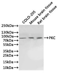 Western Blot
Positive WB detected in: COLO-205 whole cell lysate(30µg), Mouse brain tissue lysate(30µg), Rat brain tissue lysate(30µg)
All lanes: PKC antibody at 1:1000
Secondary
Goat polyclonal to rabbit IgG at 1/40000 dilution
Predicted band size: 37, 40, 68-84 kDa
Observed band size: 77 kDa
Exposure time：30s