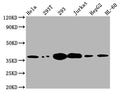 Western Blot
Positive WB detected in: Hela whole cell lysate, 293T whole cell lysate, 293 whole cell lysate, Jurkat whole cell lysate, HepG2 whole cell lysate, HL-60 whole cell lysate
All lanes: Thymidylate Synthase antibody at 1:2000
Secondary
Goat polyclonal to rabbit IgG at 1/50000 dilution
Predicted band size: 36, 32, 27 kDa
Observed band size: 36 kDa