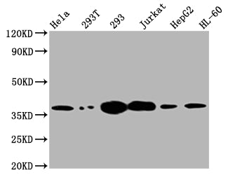 Western Blot
Positive WB detected in: Hela whole cell lysate, 293T whole cell lysate, 293 whole cell lysate, Jurkat whole cell lysate, HepG2 whole cell lysate, HL-60 whole cell lysate
All lanes: Thymidylate Synthase antibody at 1:2000
Secondary
Goat polyclonal to rabbit IgG at 1/50000 dilution
Predicted band size: 36, 32, 27 kDa
Observed band size: 36 kDa
