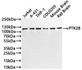Western Blot
Positive WB detected in: Jurkat whole cell lysate(30µg), A431 whole cell lysate(30µg), THP-1 whole cell lysate(30µg), COLO205 whole cell lysate(30µg), Mouse brain tissue lysate(30µg), Rat brain tissue lysate(30µg)
All lanes:PTK2B antibody at 1:1000
Secondary
Goat polyclonal to rabbit IgG at 1/40000 dilution
Predicted band size: 116 kDa
Observed band size: 116 kDa
Exposure time：1min