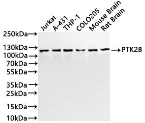 Western Blot
Positive WB detected in: Jurkat whole cell lysate(30µg), A431 whole cell lysate(30µg), THP-1 whole cell lysate(30µg), COLO205 whole cell lysate(30µg), Mouse brain tissue lysate(30µg), Rat brain tissue lysate(30µg)
All lanes:PTK2B antibody at 1:1000
Secondary
Goat polyclonal to rabbit IgG at 1/40000 dilution
Predicted band size: 116 kDa
Observed band size: 116 kDa
Exposure time：1min