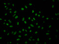 Immunofluorescence staining of Hela Cells with CSB-RA585624A0HU at 1:50, counter-stained with DAPI. The cells were fixed in 4% formaldehyde, permeated by 0.2% TritonX-100, and blocked in 10% normal Goat Serum. The cells were then incubated with the antibody overnight at 4℃. Nuclear DNA was labeled in blue with DAPI. The secondary antibody was FITC-conjugated AffiniPure Goat Anti-Rabbit IgG (H+L) .