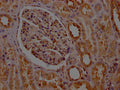 IHC image of CSB-RA585843A0HU diluted at 1:100 and staining in paraffin-embedded human kidney tissue performed on a Leica BondTM system. After dewaxing and hydration, antigen retrieval was mediated by high pressure in a citrate buffer (pH 6.0) . Section was blocked with 10% normal goat serum 30min at RT. Then primary antibody (1% BSA) was incubated at 4℃ overnight. The primary is detected by a Goat anti-rabbit IgG polymer labeled by HRP and visualized using 0.05% DAB.