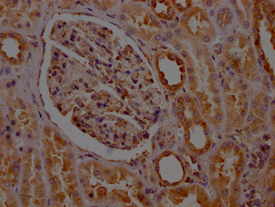 IHC image of CSB-RA585843A0HU diluted at 1:100 and staining in paraffin-embedded human kidney tissue performed on a Leica BondTM system. After dewaxing and hydration, antigen retrieval was mediated by high pressure in a citrate buffer (pH 6.0) . Section was blocked with 10% normal goat serum 30min at RT. Then primary antibody (1% BSA) was incubated at 4℃ overnight. The primary is detected by a Goat anti-rabbit IgG polymer labeled by HRP and visualized using 0.05% DAB.