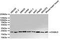 Western Blot
Positive WB detected in: HEK293 whole cell lysate(30µg) ,PC-3 whole cell lysate(30µg) ,SW620 whole cell lysate(30µg) ,Jurkat whole cell lysate(30µg) ,MCF-7 whole cell lysate(30µg) ,A431 whole cell lysate(30µg) ,HepG2 whole cell lysate(30µg) ,NIH/3T3 whole cell lysate(30µg) ,Mouse heart tissue lysate(30µg) 
All lanes: DIABLO antibody at 1:1000
Secondary
Goat polyclonal to rabbit IgG at 1/40000 dilution
Predicted band size: 27 kDa
Observed band size: 21 kDa
Exposure time：20s