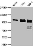 Western Blot
Positive WB detected in: K562 whole cell lysate, U-251 whole cell lysate, THP-1 whole cell lysate
All lanes: ITCH antibody at 1:1000
Secondary
Goat polyclonal to rabbit IgG at 1/50000 dilution
Predicted band size: 103, 99, 87 kDa
Observed band size: 103 kDa