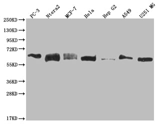 Western Blot
Positive WB detected in: PC3 whole cell lysate, Ntera-2 whole cell lysate, MCF-7 whole cell lysate, Hela whole cell lysate, HepG2 whole cell lysate, A549 whole cell lysate, U251 whole cell lysate
All lanes: USP14 antibody at 1:2000
Secondary
Goat polyclonal to rabbit IgG at 1/50000 dilution
Predicted band size: 57, 53, 55 kDa
Observed band size: 55-72 kDa