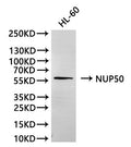 Western Blot
Positive WB detected in: HL-60 whole cell lysate(30µg)
All lanes: NUP50 antibody at 1:1000
Secondary
Goat polyclonal to rabbit IgG at 1/40000 dilution
Predicted band size: 50 kDa
Observed band size: 58 kDa
Exposure time：2min