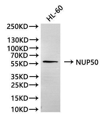 Western Blot
Positive WB detected in: HL-60 whole cell lysate(30µg)
All lanes: NUP50 antibody at 1:1000
Secondary
Goat polyclonal to rabbit IgG at 1/40000 dilution
Predicted band size: 50 kDa
Observed band size: 58 kDa
Exposure time：2min