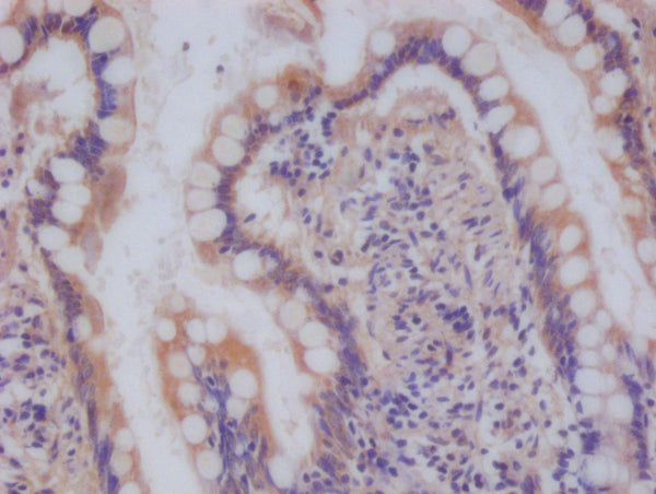IHC image of CSB-RA588190A0HU diluted at 1:100 and staining in paraffin-embedded human small intestine tissue performed on a Leica BondTM system. After dewaxing and hydration, antigen retrieval was mediated by high pressure in a citrate buffer (pH 6.0) . Section was blocked with 10% normal goat serum 30min at RT. Then primary antibody (1% BSA) was incubated at 4°C overnight. The primary is detected by a Goat anti-rabbit polymer IgG labeled by HRP and visualized using 0.05% DAB.