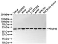 Western Blot
Positive WB detected in: HeLa whole cell lysate(30µg) , SH-SY5Y whole cell lysate(30µg) , K562 whole cell lysate(30µg) , HepG2 whole cell lysate(30µg) , U-251MG whole cell lysate(30µg) , A549 whole cell lysate(30µg) , HEK293 whole cell lysate(30µg) , Rat brain tissue lysate(30µg) 
All lanes: TDP43 antibody at 1:1000
Secondary
Goat polyclonal to rabbit IgG at 1/50000 dilution
Predicted band size: 45 kDa
Observed band size: 45 kDa
Exposure time: 2min