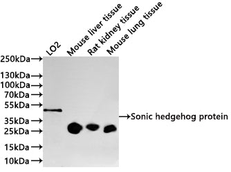 Western Blot
Positive WB detected in: LO2 whole cell lysate(30µg) , Mouse liver tissue lysate(30µg) , Rat kidney tissue lysate(30µg) , Mouse lung tissue lysate(30µg) 
All lanes: Sonic hedgehog protein antibody at 1:1000
Secondary
Goat polyclonal to rabbit IgG at 1/40000 dilution
Predicted band size: 50 kDa
Observed band size: 28/50 kDa
Exposure time：1min