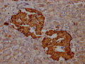 IHC image of CSB-RA588381A0HU diluted at 1:100 and staining in paraffin-embedded human pancreatic tissue performed on a Leica BondTM system. After dewaxing and hydration, antigen retrieval was mediated by high pressure in a citrate buffer (pH 6.0) . Section was blocked with 10% normal goat serum 30min at RT. Then primary antibody (1% BSA) was incubated at 4℃ overnight. The primary is detected by a Goat anti-rabbit IgG polymer labeled by HRP and visualized using 0.05% DAB.