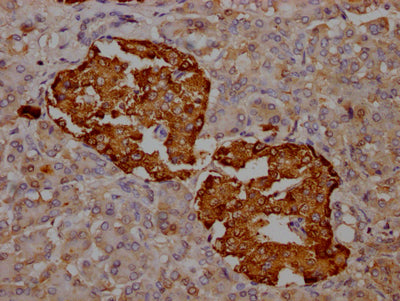 IHC image of CSB-RA588381A0HU diluted at 1:100 and staining in paraffin-embedded human pancreatic tissue performed on a Leica BondTM system. After dewaxing and hydration, antigen retrieval was mediated by high pressure in a citrate buffer (pH 6.0) . Section was blocked with 10% normal goat serum 30min at RT. Then primary antibody (1% BSA) was incubated at 4℃ overnight. The primary is detected by a Goat anti-rabbit IgG polymer labeled by HRP and visualized using 0.05% DAB.