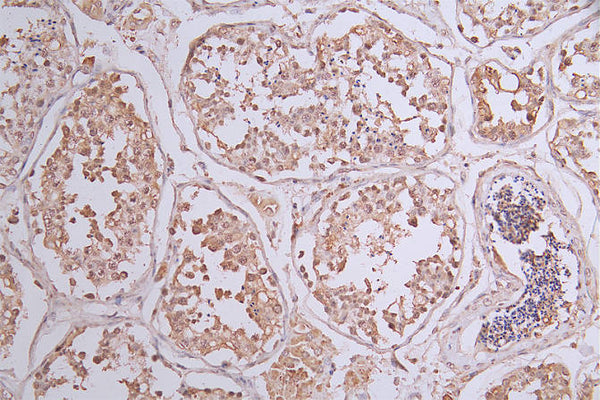IHC image of CSB-RA588766A0HU diluted at 1:50 and staining in paraffin-embedded human testis tissue performed on a Leica BondTM system. After dewaxing and hydration, antigen retrieval was mediated by high pressure in a citrate buffer (pH 6.0) . Section was blocked with 10% normal goat serum 30min at RT. Then primary antibody (1% BSA) was incubated at 4°C overnight. The primary is detected by a Goat anti-rabbit polymer IgG labeled by HRP and visualized using 0.23% DAB.
