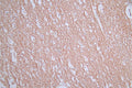 IHC image of CSB-RA588962A0HU diluted at 1:50 and staining in paraffin-embedded human brain tissue performed on a Leica BondTM system. After dewaxing and hydration, antigen retrieval was mediated by high pressure in a citrate buffer (pH 6.0) . Section was blocked with 10% normal goat serum 30min at RT. Then primary antibody (1% BSA) was incubated at 4°C overnight. The primary is detected by a Goat anti-rabbit polymer IgG labeled by HRP and visualized using 0.76% DAB.