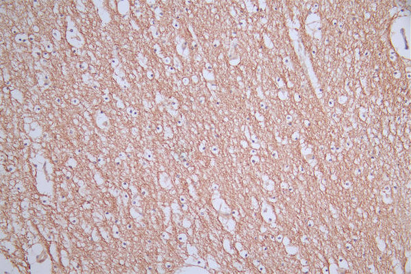 IHC image of CSB-RA588962A0HU diluted at 1:50 and staining in paraffin-embedded human brain tissue performed on a Leica BondTM system. After dewaxing and hydration, antigen retrieval was mediated by high pressure in a citrate buffer (pH 6.0) . Section was blocked with 10% normal goat serum 30min at RT. Then primary antibody (1% BSA) was incubated at 4°C overnight. The primary is detected by a Goat anti-rabbit polymer IgG labeled by HRP and visualized using 0.76% DAB.