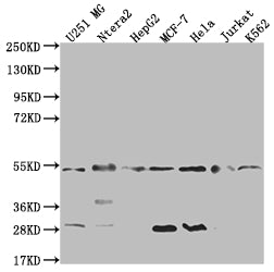 Western Blot
Positive WB detected in: U251 whole cell lysate, Ntera-2 whole cell lysate, HepG2 whole cell lysate, MCF-7 whole cell lysate, Hela whole cell lysate, Jurkat whole cell lysate, K562 whole cell lysate
All lanes: DNAJA1 antibody at 1:2000
Secondary
Goat polyclonal to rabbit IgG at 1/50000 dilution
Predicted band size: 45, 38 kDa
Observed band size: 45-55 kDa