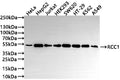 Western Blot
Positive WB detected in: HeLa whole cell lysate(30µg) , HepG2 whole cell lysate(30µg) , Jurkat whole cell lysate(30µg) , HEK293 whole cell lysate(30µg) , SW620 whole cell lysate(30µg) , HT-29 whole cell lysate(30µg) , K562 whole cell lysate(30µg) , A549 whole cell lysate(30µg) 
All lanes: RCC1 antibody at 1:1000
Secondary
Goat polyclonal to rabbit IgG at 1/50000 dilution
Predicted band size: 45 kDa
Observed band size: 50 kDa
Exposure time: 1min