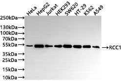 Western Blot
Positive WB detected in: HeLa whole cell lysate(30µg) , HepG2 whole cell lysate(30µg) , Jurkat whole cell lysate(30µg) , HEK293 whole cell lysate(30µg) , SW620 whole cell lysate(30µg) , HT-29 whole cell lysate(30µg) , K562 whole cell lysate(30µg) , A549 whole cell lysate(30µg) 
All lanes: RCC1 antibody at 1:1000
Secondary
Goat polyclonal to rabbit IgG at 1/50000 dilution
Predicted band size: 45 kDa
Observed band size: 50 kDa
Exposure time: 1min