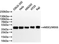 Western Blot
Positive WB detected in: COLO-205 whole cell lysate(30µg) , Hela whole cell lysate(30µg) ,HEK293 whole cell lysate(30µg) ,HT-29 whole cell lysate(30µg) ,Raji whole cell lysate(30µg) 
All lanes: MEK3/MEK6 antibody at 1:1000
Secondary
Goat polyclonal to rabbit IgG at 1/40000 dilution
Predicted band size: 37，39 kDa
Observed band size: 37，39 kDa
Exposure time：2min