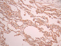 IHC image of CSB-RA591955A0HU diluted at 1:100 and staining in paraffin-embedded human lung tissue performed on a Leica BondTM system. After dewaxing and hydration, antigen retrieval was mediated by high pressure in a citrate buffer (pH 6.0). Section was blocked with 10% normal goat serum 30min at RT. Then primary antibody (1% BSA) was incubated at 4°C overnight. The primary is detected by a Goat anti-rabbit polymer IgG labeled by HRP and visualized using 0.05% DAB.
