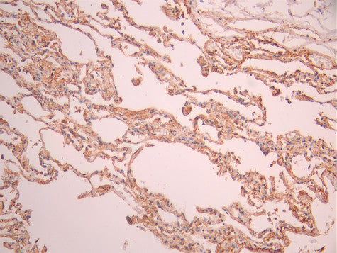 IHC image of CSB-RA591955A0HU diluted at 1:100 and staining in paraffin-embedded human lung tissue performed on a Leica BondTM system. After dewaxing and hydration, antigen retrieval was mediated by high pressure in a citrate buffer (pH 6.0). Section was blocked with 10% normal goat serum 30min at RT. Then primary antibody (1% BSA) was incubated at 4°C overnight. The primary is detected by a Goat anti-rabbit polymer IgG labeled by HRP and visualized using 0.05% DAB.