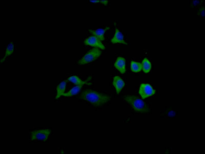 Immunofluorescence staining of HepG2 Cells with CSB-RA592348A0HU at 1:50, counter-stained with DAPI. The cells were fixed in 4% formaldehyde, permeated by 0.2% TritonX-100, and blocked in 10% normal Goat Serum. The cells were then incubated with the antibody overnight at 4℃. Nuclear DNA was labeled in blue with DAPI. The secondary antibody was FITC-conjugated AffiniPure Goat Anti-Rabbit IgG (H+L) .