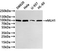 Western Blot
Positive WB detected in: SW620 whole cell lysate(20µg) , Hela whole cell lysate(20µg) ,U-937 whole cell lysate(20µg) ,HL-60 whole cell lysate(20µg) 
All lanes: MLH1 antibody at 1:1000
Secondary
Goat polyclonal to rabbit IgG at 1/40000 dilution
Predicted band size: 85 kDa
Observed band size: 100 kDa
Exposure time：2min