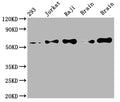 Western Blot
Positive WB detected in: 293 whole cell lysate, Jurkat whole cell lysate, Raji whole cell lysate, Mouse brain tissue, Rat brain tissue
All lanes: PAK2 antibody at 1:2000
Secondary
Goat polyclonal to rabbit IgG at 1/50000 dilution
Predicted band size: 59 kDa
Observed band size: 59 kDa