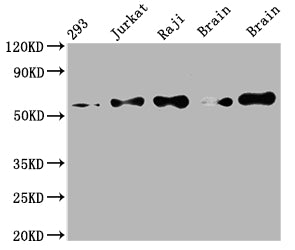 Western Blot
Positive WB detected in: 293 whole cell lysate, Jurkat whole cell lysate, Raji whole cell lysate, Mouse brain tissue, Rat brain tissue
All lanes: PAK2 antibody at 1:2000
Secondary
Goat polyclonal to rabbit IgG at 1/50000 dilution
Predicted band size: 59 kDa
Observed band size: 59 kDa