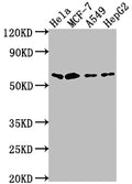 Western Blot
Positive WB detected in: Hela whole cell lysate, MCF-7 whole cell lysate, A549 whole cell lysate, HepG2 whole cell lysate
All lanes: SOX10 antibody at 1:2000
Secondary
Goat polyclonal to rabbit IgG at 1/50000 dilution
Predicted band size: 50, 32 kDa
Observed band size: 60 kDa