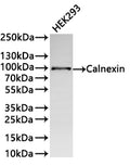 Western Blot
Positive WB detected in: HEK293 whole cell lysate(30µg) 
All lanes: Calnexin antibody at 1:1000
Secondary
Goat polyclonal to rabbit IgG at 1/40000 dilution
Predicted band size: 68 kDa
Observed band size: 94 kDa
Exposure time：10s