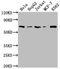 Observed band size: 37 kDa