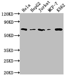 Observed band size: 37 kDa