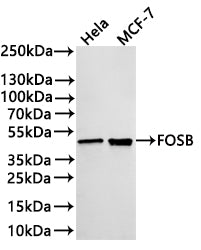 Western Blot
Positive WB detected in: Hela whole cell lysate(30µg) , MCF-7 whole cell lysate(30µg) 
All lanes: FOSB antibody at 1:1000
Secondary
Goat polyclonal to rabbit IgG at 1/40000 dilution
Predicted band size: 36 kDa
Observed band size: 48 kDa
Exposure time：2min